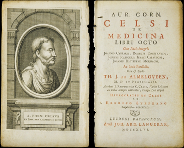 上图：塞尔苏斯（Aulus Cornelius Celsus，主前25-主后50年）编纂的百科全书《医术 De Medicina》。在这本书中提到希腊文称为elephantiasis graecorum的疾病，症状与现代的麻风病相似。但主前3-2世纪的希腊文七十士译本却把「大麻风 ???????」译为Λ?πρα（lepra），意思是「使皮肤有鳞的病」。主后5世纪耶柔米（Jerome）在翻译拉丁文武加大译本时，也没有使用学名elephantiasis graecorum，而是使用lepra的音译，表明他并不认为lepra就是麻风病，而只是一种恶性皮肤病。从lepra转变来的英文leprosy，后来被用来称呼「麻风病 Hansen's Disease」。